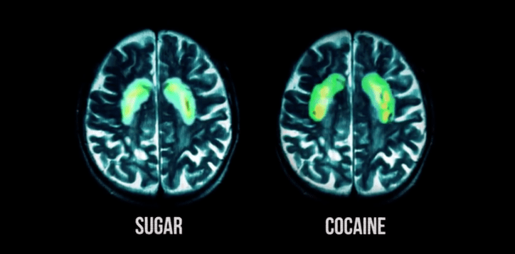 In je brein gebeurt hetzelfde wanneer je suiker eet als wanneer je cocaine gebruikt